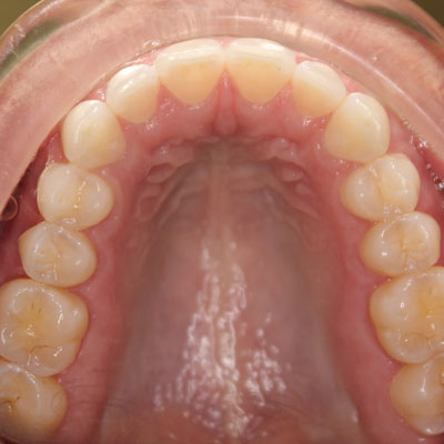 best orthodontist coral springs