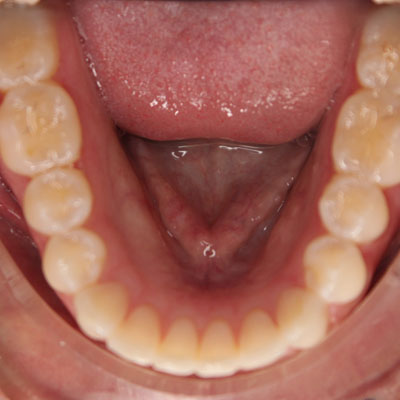 best orthodontist parkland
